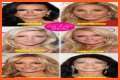 Botox, Implants & More! – Hollywood Life