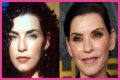 Julianna Margulies Doesn’t Look Natural After Plastic Surgery!